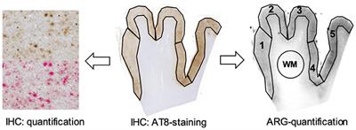 Superiority of Formalin-Fixed Paraffin-Embedded Brain Tissue for in vitro Assessment of Progressive Supranuclear Palsy Tau Pathology With [18F]PI-2620